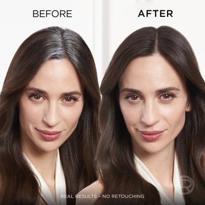 L&#039;Oréal Paris Magic Retouch Instant Root Concealer Spray Boja za kosu za žene 75 ml Nijansa Dark Brown